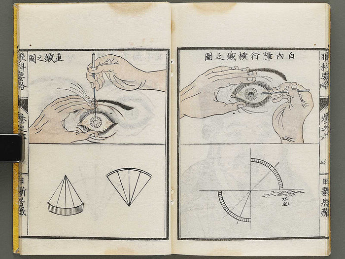 Ganka yoryaku Part 2, Book 6 / BJ325-143